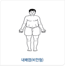 내배엽(비만형) 체형 예시 이미지